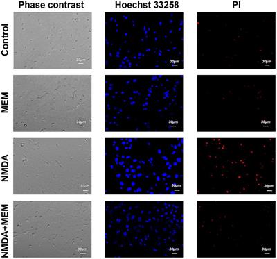 Memantine protects the cultured rat hippocampal neurons - Frontiers